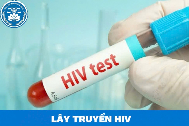 Tội lây truyền HIV cho người khác theo Bộ luật hình sự năm 2015 bị đi tù bao lâu?